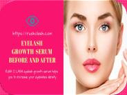 Best Eyelash Serum Before After