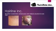 Hairline inc (1)