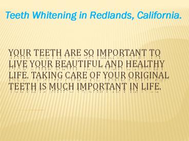 Teeth Whitening treatments in Redlands, by Dr. Nomi Lee