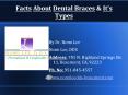 Fact About Dental Braces & It's Types PowerPoint PPT Presentation