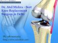 Best Knee Replacement Surgeon in Delhi (1) PowerPoint PPT Presentation
