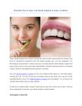 Essential Tips to Keep Your Dental Implants in Great Condition PowerPoint PPT Presentation