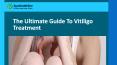 The Ultimate Guide To Vitiligo Treatment PowerPoint PPT Presentation