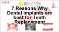 Why Dental Implants are the Best Solution for Missing Teeth? PowerPoint PPT Presentation