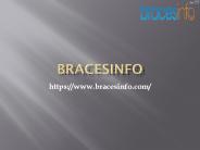 Reviews invisalign
