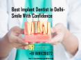Best Implant Dentist in Delhi | Dental implant in Delhi PowerPoint PPT Presentation