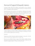 Removal of Surgical Orthopedic Implants PowerPoint PPT Presentation