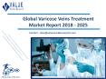 Varicose Veins Treatment Market: Global Industry Opportunity Analysis and Forecast to 2025 PowerPoint PPT Presentation