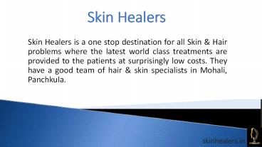 Hair Restoration Treatment in Panchkula