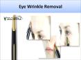 Eye Wrinkle Removal PowerPoint PPT Presentation