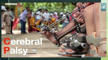 Cerebral Palsy|Trishla Foundation.