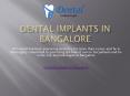 Dental implants in Bangalore PowerPoint PPT Presentation
