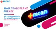 Hair Transplant Turkey