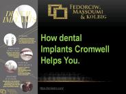 What Do You Understand By Dental Implant?