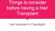 Things to consider before having a hair transplant