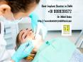 Best Implant Dentist in Delhi | Dial +91 9999201572 PowerPoint PPT Presentation