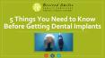 What You Need to Know Before Getting a Dental Implant? PowerPoint PPT Presentation