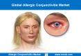 Allergic Conjunctivitis Market Size PowerPoint PPT Presentation