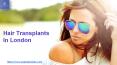Hair Transplants In London PowerPoint PPT Presentation