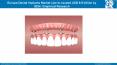 Europe Dental Implants Market PowerPoint PPT Presentation