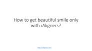 How to get beautiful smile only with iAligners? (1)