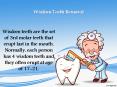 Wisdom Teeth Removal PowerPoint PPT Presentation