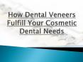 How Dental Veneers Fulfill Your Cosmetic Dental Needs PowerPoint PPT Presentation