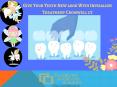Best Invisalign Treatment Cromwell ct PowerPoint PPT Presentation
