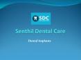 Dental Implants In Chennai PowerPoint PPT Presentation