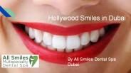Hollywood Smile in Dubai