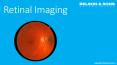 Retinal Imaging PowerPoint PPT Presentation