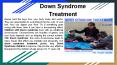 down syndrome treatment PowerPoint PPT Presentation
