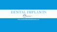 Best Dental Implant Clinic in Bannerghatta Road PowerPoint PPT Presentation