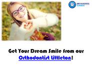 Braces Littleton (1)