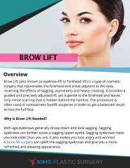 All About Brow Lift (1)