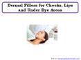 Dermal Fillers for Cheeks, Lips and Under Eye Areas PowerPoint PPT Presentation