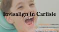 Invisalign in Carlisle PowerPoint PPT Presentation