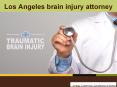 Los Angeles Brain Injury Attorneys PowerPoint PPT Presentation