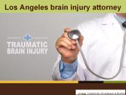 Los Angeles Brain Injury Attorneys (1)