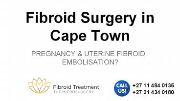 Fibroid Surgery in Cape Town
