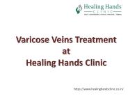Varicose Veins Treatment at Healing Hands Clinic
