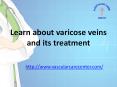 Varicose Veins Treatment In Hyderabad | Vascular Care Center PowerPoint PPT Presentation