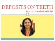 DEPOSITS ON TEETH