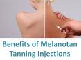 Benefits of Melanotan Tanning Injections