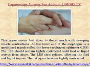 Laparoscopy Surgery San Antonio | GERD TX