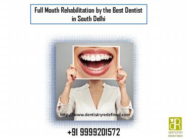 Full Mouth Rehabilitation by a Best Dentist in South Delhi