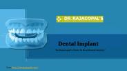 Dental Implant To Get Healthy And Strong Teeth.