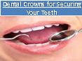 Dental Crowns for Securing Your Teeth PowerPoint PPT Presentation