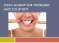 Teeth Alignment problems and solution PowerPoint PPT Presentation