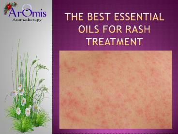 The Best Essential Oils for Rash Treatment